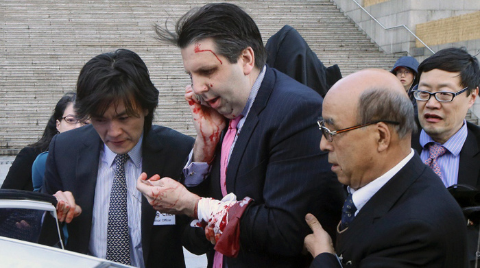 Knife Attack Hospitalizes US Ambassador to South Korea